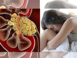 5 Warning Signs You Might Have Kidney Stones: Tips To Get Rid of Kidney Stones Naturally