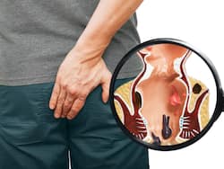 इन 5 कारणों से हो सकती है बवासीर की समस्या, कहीं आप भी तो नहीं कर रहे हैं गलतियां?