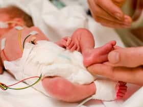 How To Prevent Preterm Birth With The Right Treatment: Cervical Cerclage How To Prevent Preterm Birth With The Right Treatment: Cervical Cerclage