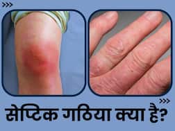 जोड़ों में इन्फेक्शन की वजह से चलने में हो सकती है परेशानी, जानिए क्या है सेप्टिक गठिया और इसका इलाज