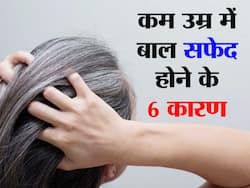 हार्मोन्स की गड़बड़ी से यंग एज में ही बाल हो जाते हैं सफेद, ये गलतियां बढ़ा देती हैं hormonal imbalance.