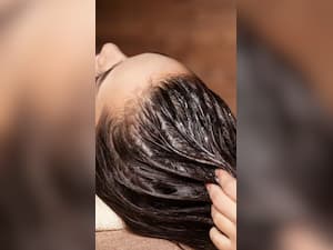 डैंड्रफ को जड़ से खत्म करने वाले 8 घरेलू उपाय