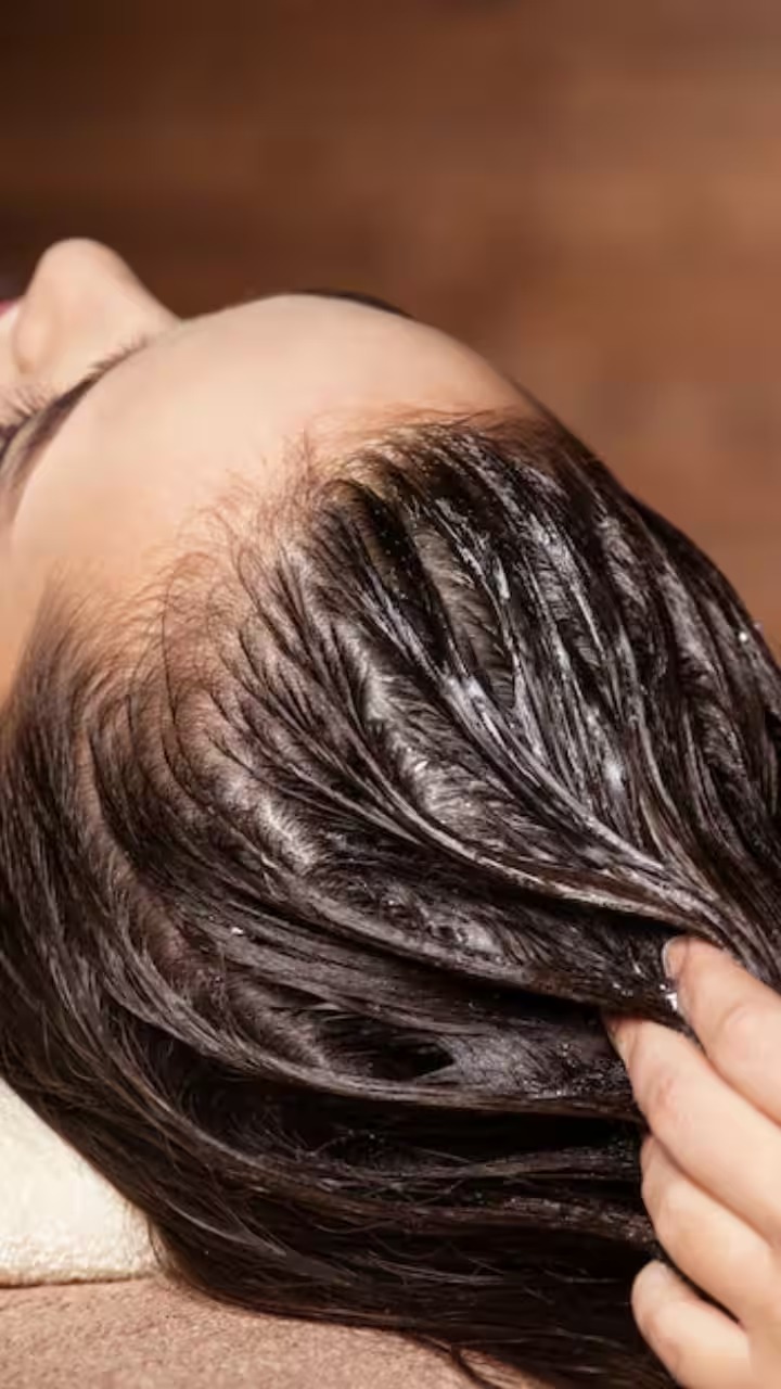 डैंड्रफ को जड़ से खत्म करने वाले 8 घरेलू उपाय