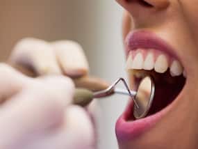 6 Most Common Oral Infectious Diseases