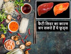 सर्दियों में ये 5 चीजें खाने से हो सकता है फैटी लिवर, सेवन बंद नहीं किया तो बढ़ सकता है लिवर डैमेज का खतरा