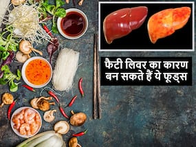 सर्दियों में ये 5 चीजें खाने से हो सकता है फैटी लिवर, सेवन बंद नहीं किया तो बढ़ सकता है लिवर डैमेज का खतरा सर्दियों में ये 5 चीजें खाने से हो सकता है फैटी लिवर, सेवन बंद नहीं किया तो बढ़ सकता है लिवर डैमेज का खतरा