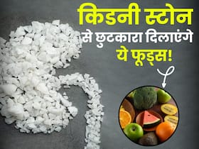 किडनी स्टोन के जानी दुश्मन हैं ये फूड्स, कुछ दिन इस्तेमाल से ही पथरी टूटकर निकल जाएगी बाहर किडनी स्टोन के जानी दुश्मन हैं ये फूड्स, कुछ दिन इस्तेमाल से ही पथरी टूटकर निकल जाएगी बाहर