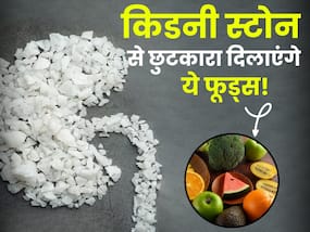किडनी स्टोन के जानी दुश्मन हैं ये फूड्स, कुछ दिन इस्तेमाल से ही पथरी टूटकर निकल जाएगी बाहर