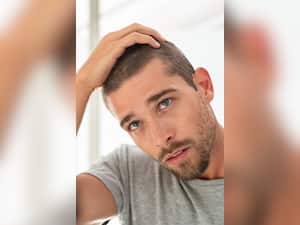 पुरुषों में बाल झड़ने के पीछे 8 कारण जिन्हें अक्सर इग्नोर कर दिया जाता है