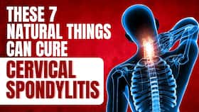 Neck Pain: How to Cure Cervical Spondylitis Permanently at Home!