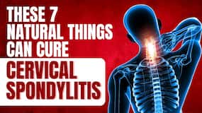 Neck Pain: How to Cure Cervical Spondylitis Permanently at Home!