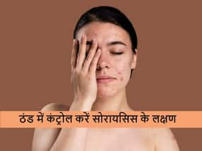 सर्दियों के मौसम में बढ़ने लगे सोरायसिस के लक्षण? कंट्रोल करने के लिए आज से ही छोड़ दें ये 5 काम