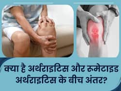 आर्थराइटिस और रूमेटाइड आर्थराइटिस में क्या है अंतर, जानें इनके कारण, लक्षण और इलाज के बारे में