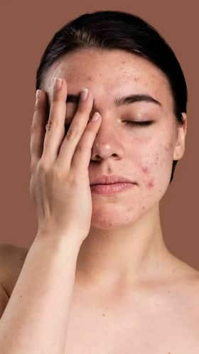8 स्किन डिजीज जिनके एक जैसे लक्षण होने के कारण इन्हें इग्नोर कर देते हैं लोग