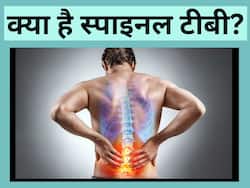 Spinal TB: क्या होता है स्पाइनल टीबी रोग और इसके 4  लक्षण जिन्हें गलती से भी इग्नोर नहीं करना चाहिए