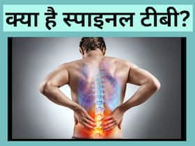 Spinal TB: क्या होता है स्पाइनल टीबी रोग और इसके 4 लक्षण जिन्हें गलती से भी इग्नोर नहीं करना चाहिए Spinal TB: क्या होता है स्पाइनल टीबी रोग और इसके 4 लक्षण जिन्हें गलती से भी इग्नोर नहीं करना चाहिए