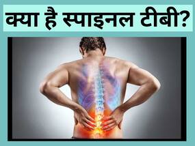 Spinal TB: क्या होता है स्पाइनल टीबी रोग और इसके 4  लक्षण जिन्हें गलती से भी इग्नोर नहीं करना चाहिए