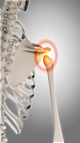 Poor Bone Mineral Density: 6 Foods That Are Making Your Bones Weaker Everyday!