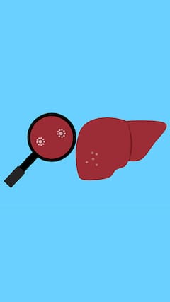 Ayurvedic Remedies For Fatty Liver Disease: Eliminate Toxins In 7 Steps