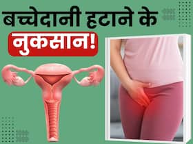 बच्चेदानी हटाने पर बढ़ने लगती हैं ये 4 परेशानियां, कम उम्र में Uterus Remove करने से पहले जान लें इसके नुकसान बच्चेदानी हटाने पर बढ़ने लगती हैं ये 4 परेशानियां, कम उम्र में Uterus Remove करने से पहले जान लें इसके नुकसान