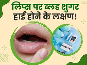 होंठों के आसपास इन 3 लक्षणों से समझ जाएं इंसुलिन का स्तर हो गया है कम, तुरंत कराएं शुगर की जांच होंठों के आसपास इन 3 लक्षणों से समझ जाएं इंसुलिन का स्तर हो गया है कम, तुरंत कराएं शुगर की जांच