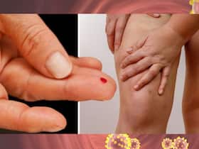 Diabetes Symptoms In Women: 7 Warning Signs of High Blood Sugar That Appears At Night On Legs and Feet Diabetes Symptoms In Women: 7 Warning Signs of High Blood Sugar That Appears At Night On Legs and Feet