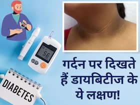गर्दन के आसपास इन संकेतों से समझ जाएं हद से ज्यादा बढ़ चुका है ब्लड शुगर, समय पर कराएं अपने खून की जांच गर्दन के आसपास इन संकेतों से समझ जाएं हद से ज्यादा बढ़ चुका है ब्लड शुगर, समय पर कराएं अपने खून की जांच