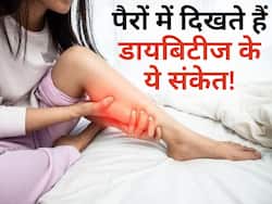 рдкреИрд░реЛрдВ рдореЗрдВ рд╣реЛ рд░рд╣реЗ рдпреЗ рд▓рдХреНрд╖рдг рдбрд╛рдпрдмрд┐рдЯреАрдЬ рдХреА рдУрд░ рдХрд░рддреЗ рд╣реИ рдЗрд╢рд╛рд░рд╛, рд╕рдордп рд░рд╣рддреЗ рд╣реЛ рдЬрд╛рдПрдВ рд╕рд╛рд╡рдзрд╛рди