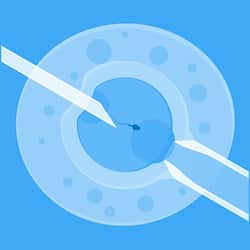 Egg Freezing For Fertility Preservation: Risks And Side Effects Of Ovarian Stimulation