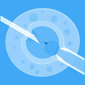 Egg Freezing For Fertility Preservation: Risks And Side Effects Of Ovarian Stimulation