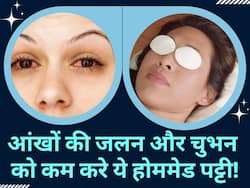 आंखों में जलन और चुभन कम करे ये चमत्कारी पट्टी, घर पर इन आसान तरीके से करें तैयार