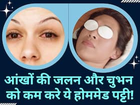 आंखों में जलन और चुभन कम करे ये चमत्कारी पट्टी, घर पर इन आसान तरीके से करें तैयार