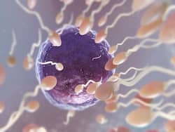 What Makes Sperm Banking A 'Strategic Resource'?