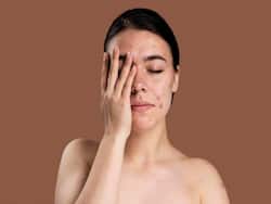 How Does Thyroid Affect The Skin? Know From A Doctor