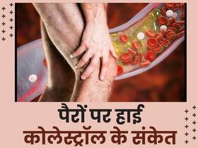 पैरों पर इन 5 संकेतों से समझ जाएं शरीर के हर एक कोने-कोने में जम चुका है LDL कोलेस्ट्रॉस, तुरंत कराएं जांच