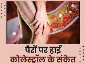 पैरों पर इन 5 संकेतों से समझ जाएं शरीर के हर एक कोने-कोने में जम चुका है LDL कोलेस्ट्रॉस, तुरंत कराएं जांच