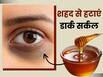 शहद से हटाएं आंखों के नीचे मौजूद डार्क सर्कल्स, इन 3 तरीकों से करें इस्तेमाल