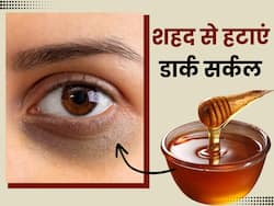 शहद से हटाएं आंखों के नीचे मौजूद डार्क सर्कल्स, इन 3 तरीकों से करें इस्तेमाल