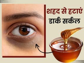 शहद से हटाएं आंखों के नीचे मौजूद डार्क सर्कल्स, इन 3 तरीकों से करें इस्तेमाल