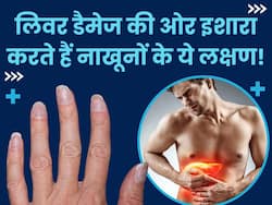 नाखूनों में दिखने वाले ये 5 लक्षण लिवर डैमेज का हो सकते हैं संकेत, 99 फीसदी लोग कर देते हैं इग्नोर