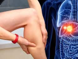 Liver Health: 7 Signs of Liver Failure That Can Show Up In Your Legs And Feet At Night