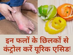 यूरिक एसिड को शरीर से नींबू के रस की तरह निचोड़ फेकेंगा ये 5 फलों का छिलका, दर्द और सूजन से भी मिलेगा आराम