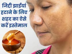 धब्बेदार जिद्दी झाइयां मिटाने के लिए शहद में मिलाकर लगाएं ये 5 चीजें, कुछ ही दिनों में बढ़ेगी चेहरे की खूबसूरती