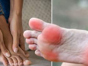 Vitamin B12 Deficiency Symptoms In 30s Women: 7 Warning Signs of Vitamin B12 Deficiency On Legs And Feet Vitamin B12 Deficiency Symptoms In 30s Women: 7 Warning Signs of Vitamin B12 Deficiency On Legs And Feet