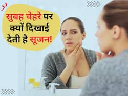 सुबह-सुबह चेहरे पर दिखाई देती है सूजन? तो इन गंभीर बीमारियों का हो सकता है खतरा