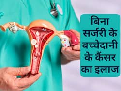 बिना सर्जरी के बच्चेदानी का कैंसर कैसे ठीक हो सकता है? जानें सबसे सस्ता इलाज