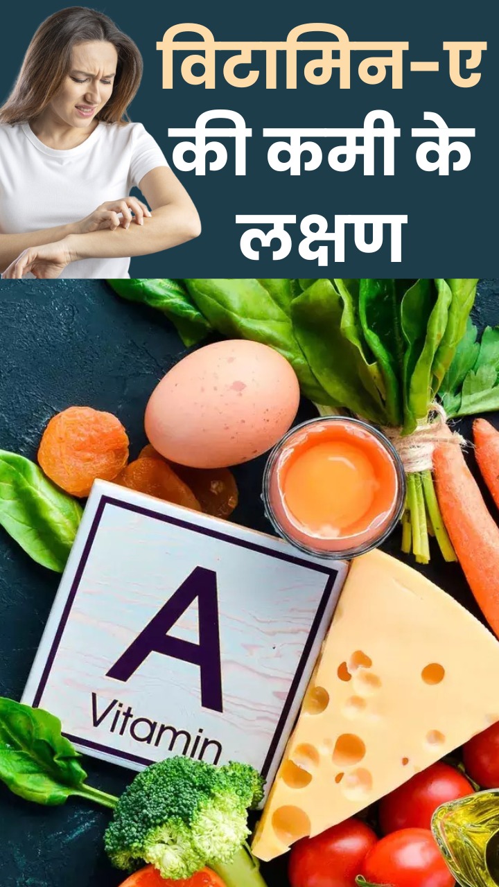 शरीर में विटामिन-ए की कमी के 8 लक्षण