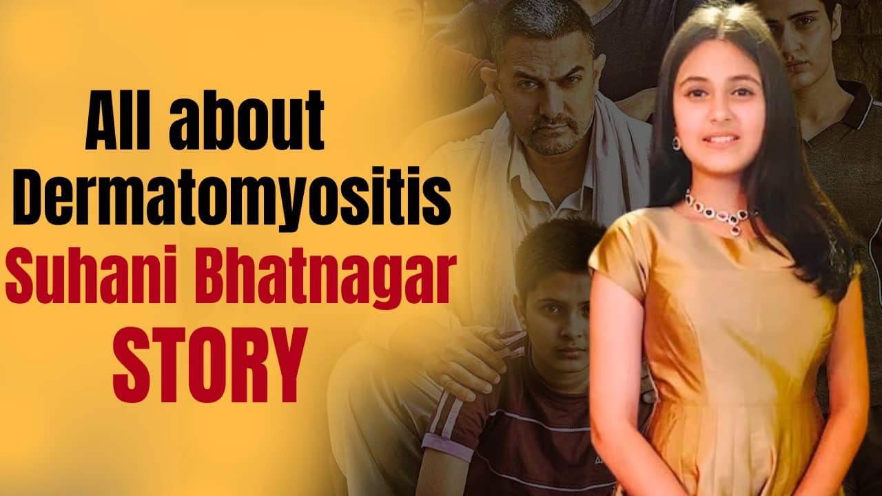 Dermatomyosite : l’actrice de Dangal Suhani Bhatnagar est décédée de cette maladie rare