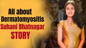 Dermatomyositis: Dangal Actress Suhani Bhatnagar Died Of This Rare Disease