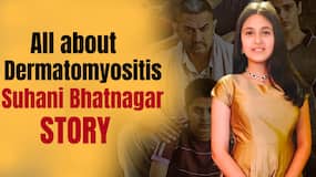Dermatomyositis: Dangal Actress Suhani Bhatnagar Died Of This Rare Disease Dermatomyositis: Dangal Actress Suhani Bhatnagar Died Of This Rare Disease